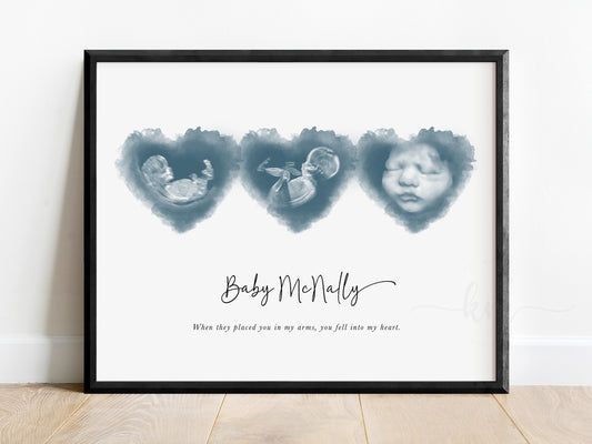Three Hearts Watercolor Ultrasound Art