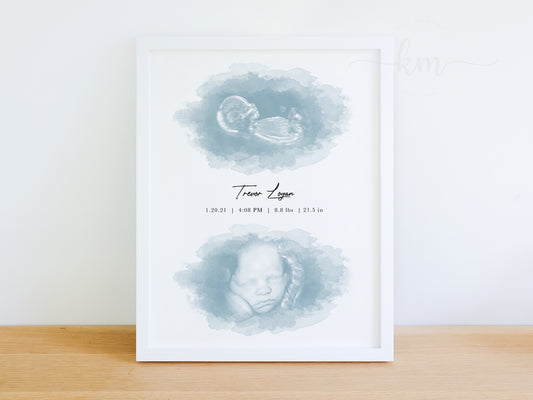 Two Ovals Watercolor Ultrasound Art