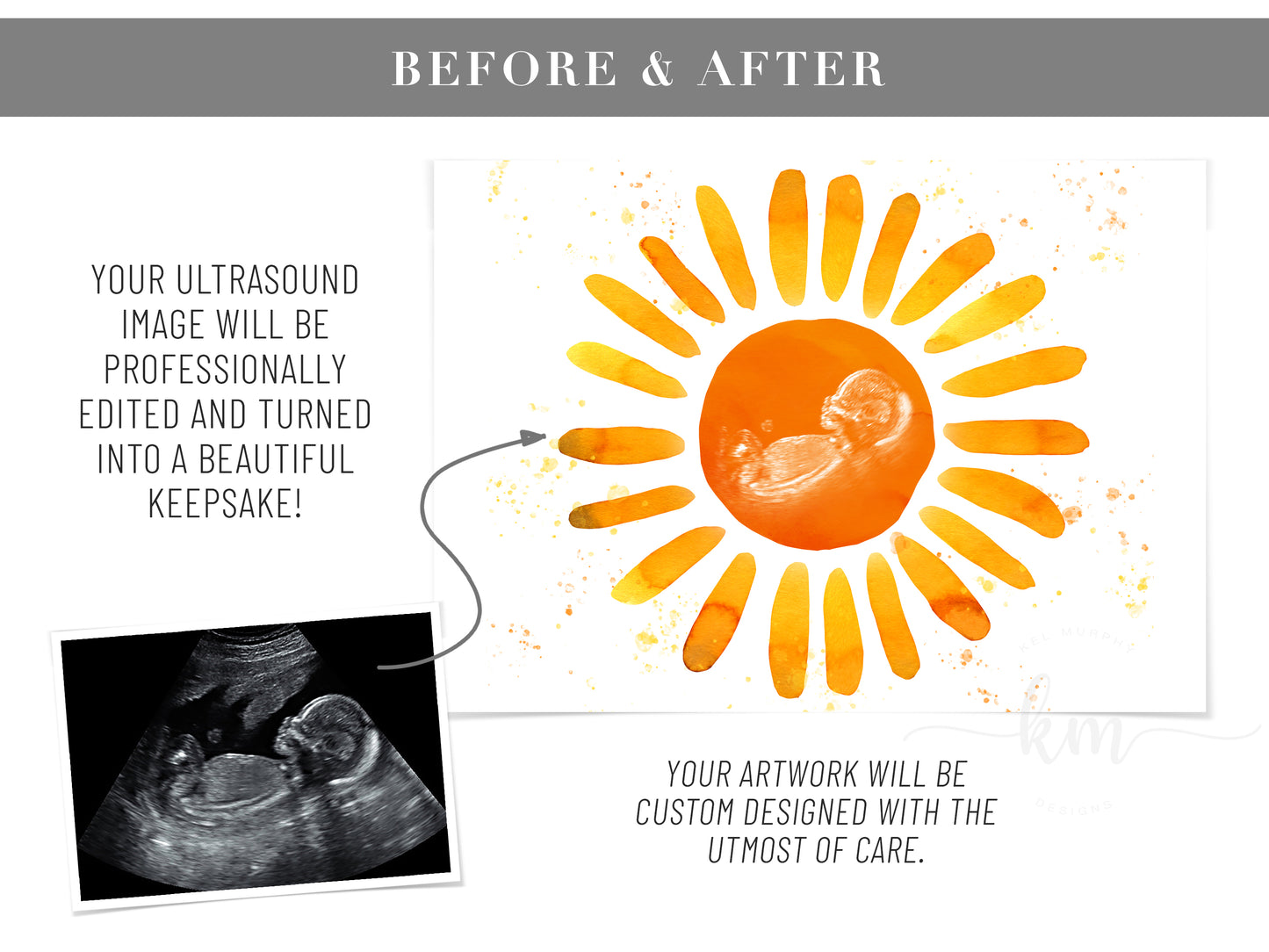 You Are My Sunshine Watercolor Ultrasound Art