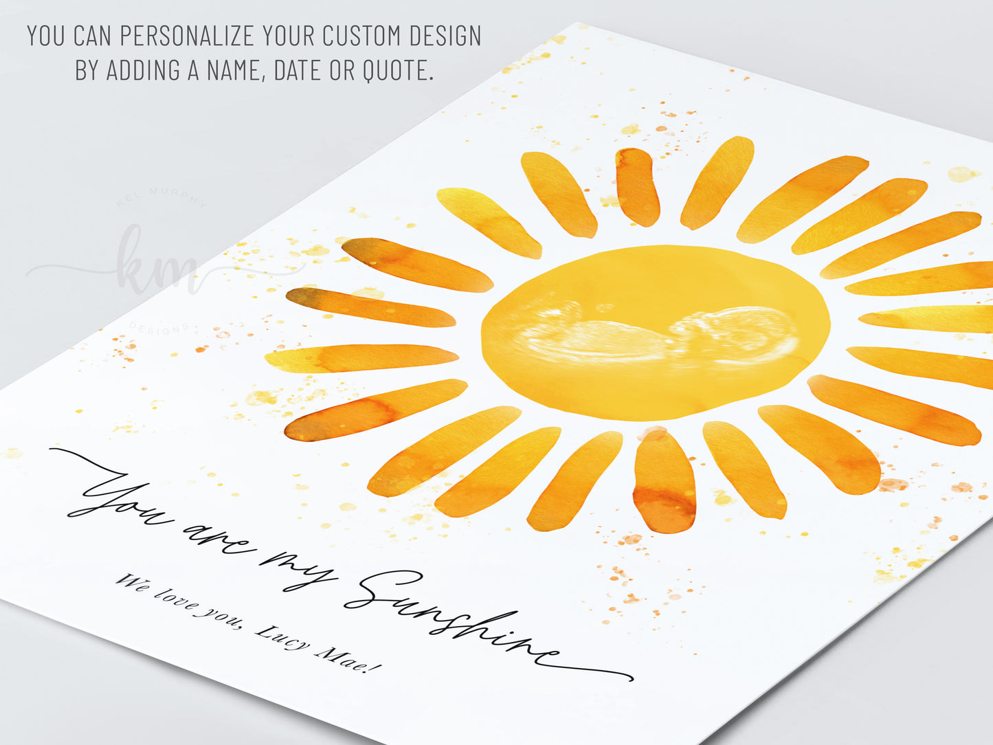 You Are My Sunshine Watercolor Ultrasound Art