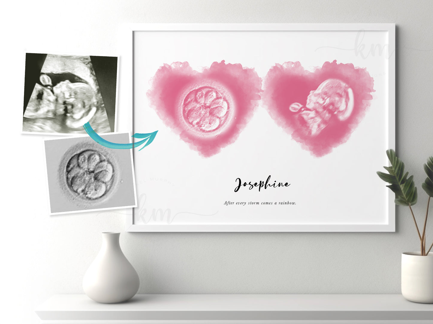 Two Hearts Watercolor IVF Embryo & Ultrasound Art