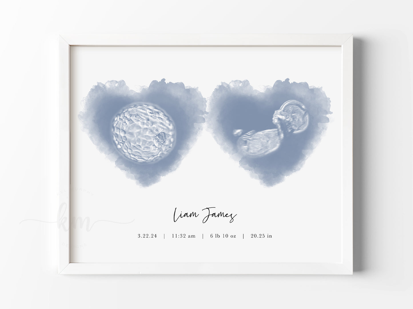 Two Hearts Watercolor IVF Embryo & Ultrasound Art