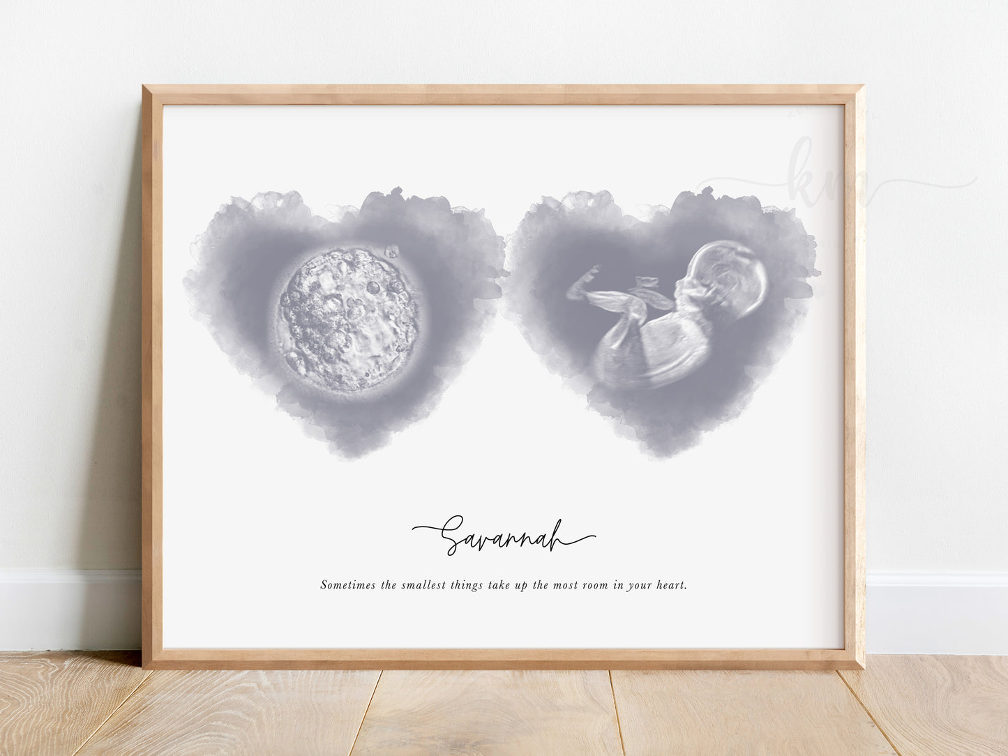 Two Hearts Watercolor IVF Embryo & Ultrasound Art
