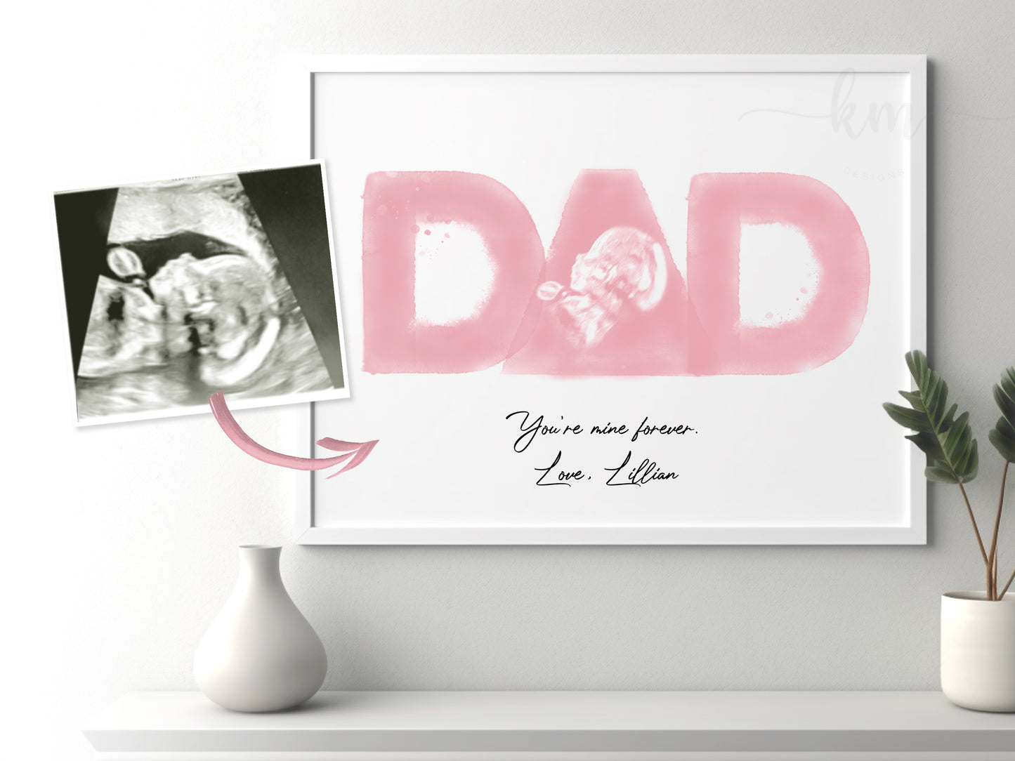 DAD Watercolor Ultrasound Art