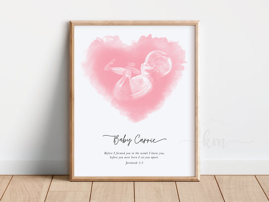 Heart Watercolor Ultrasound Art (Vertical)