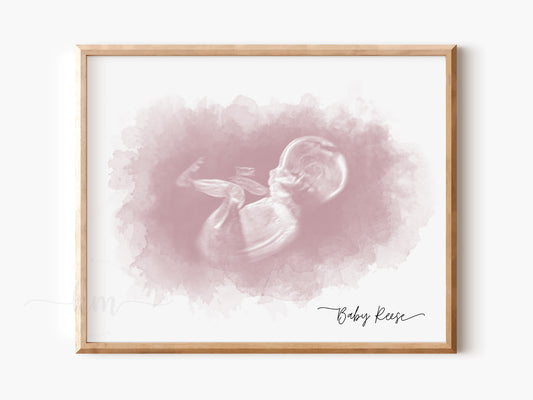 Rectangle Watercolor Ultrasound Art