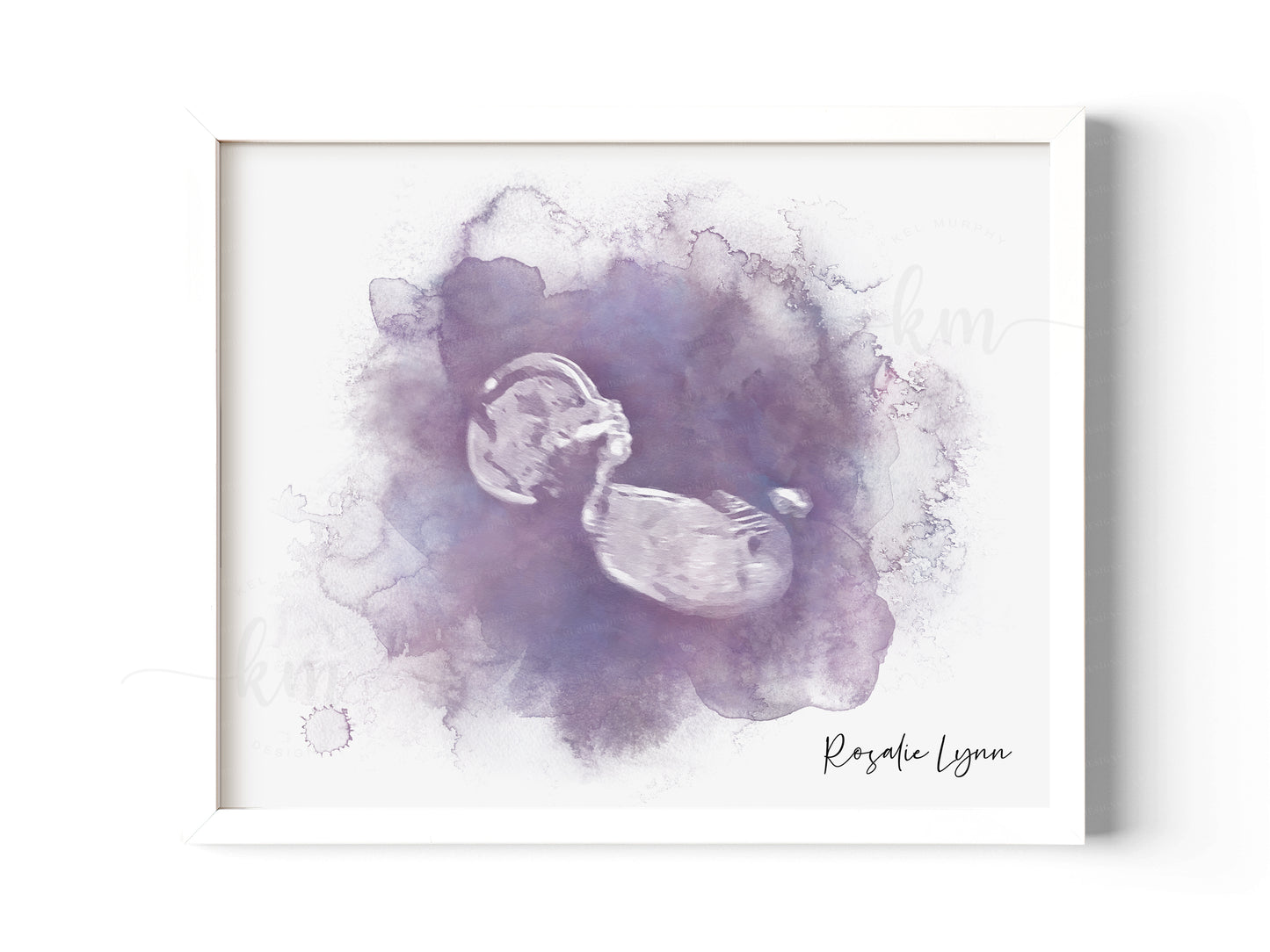Hand-Painted Watercolor Ultrasound Art