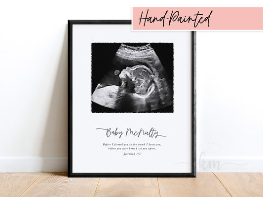 Hand-Painted Black & White Watercolor Ultrasound Art (Vertical)