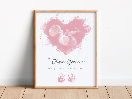 Splatter Heart Watercolor Ultrasound Art with Handprints or Footprints
