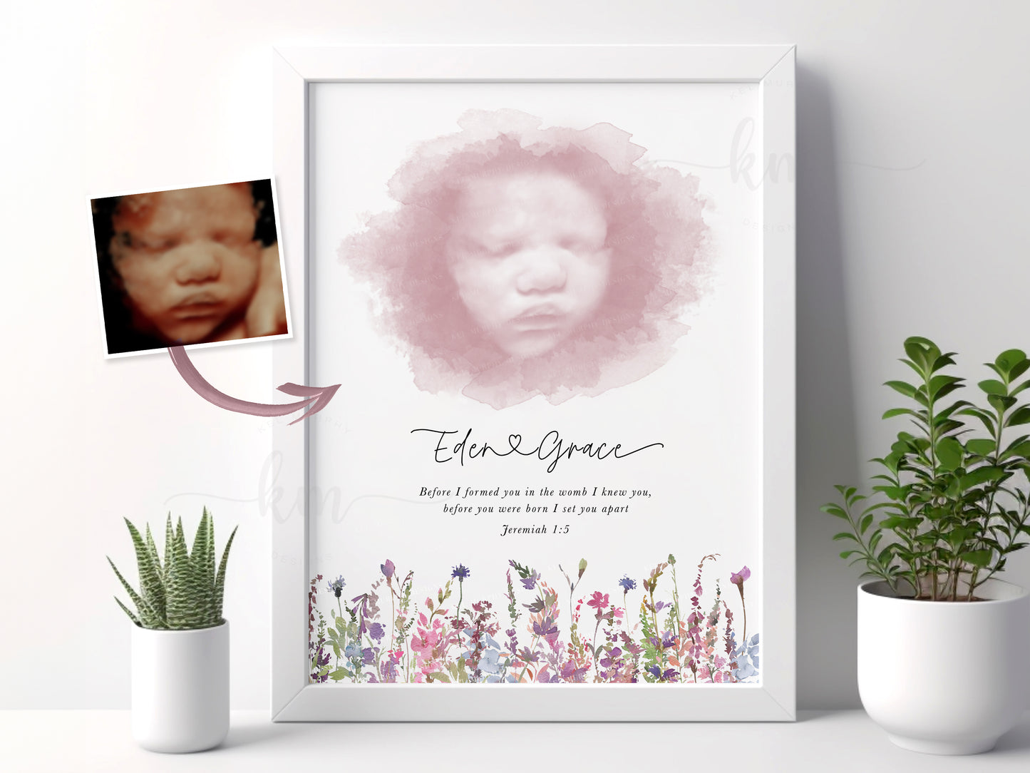 Wildflowers Watercolor Ultrasound Art (Vertical)