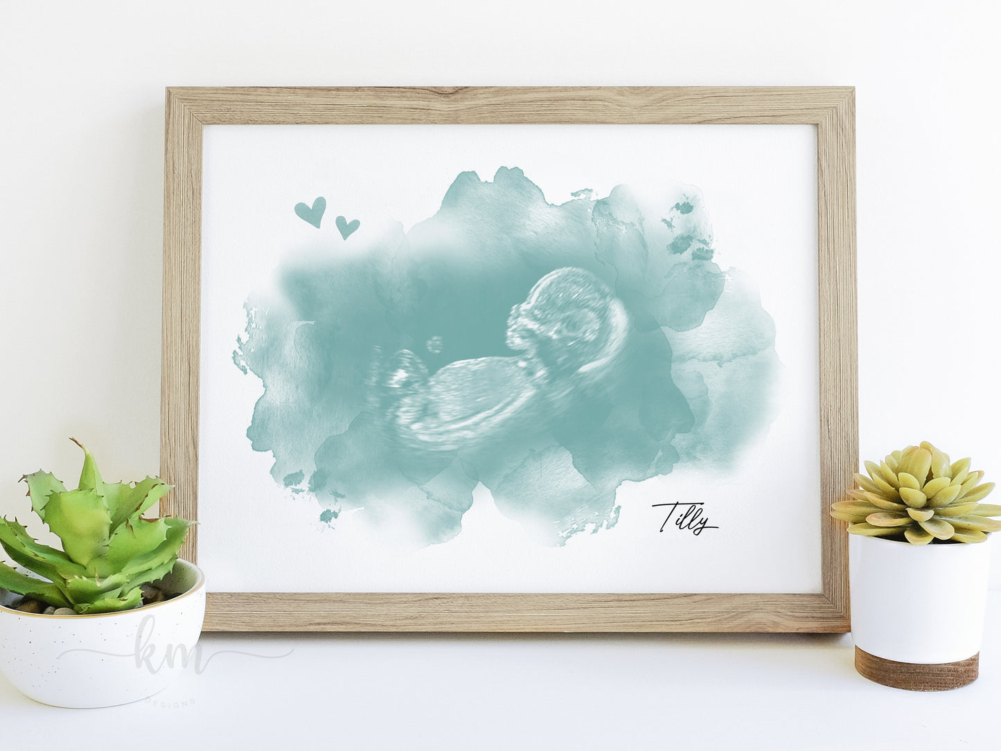 Cloud and Hearts Watercolor Ultrasound Art