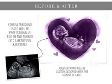 Load image into Gallery viewer, Hearts Pen &amp; Ink Ultrasound Art
