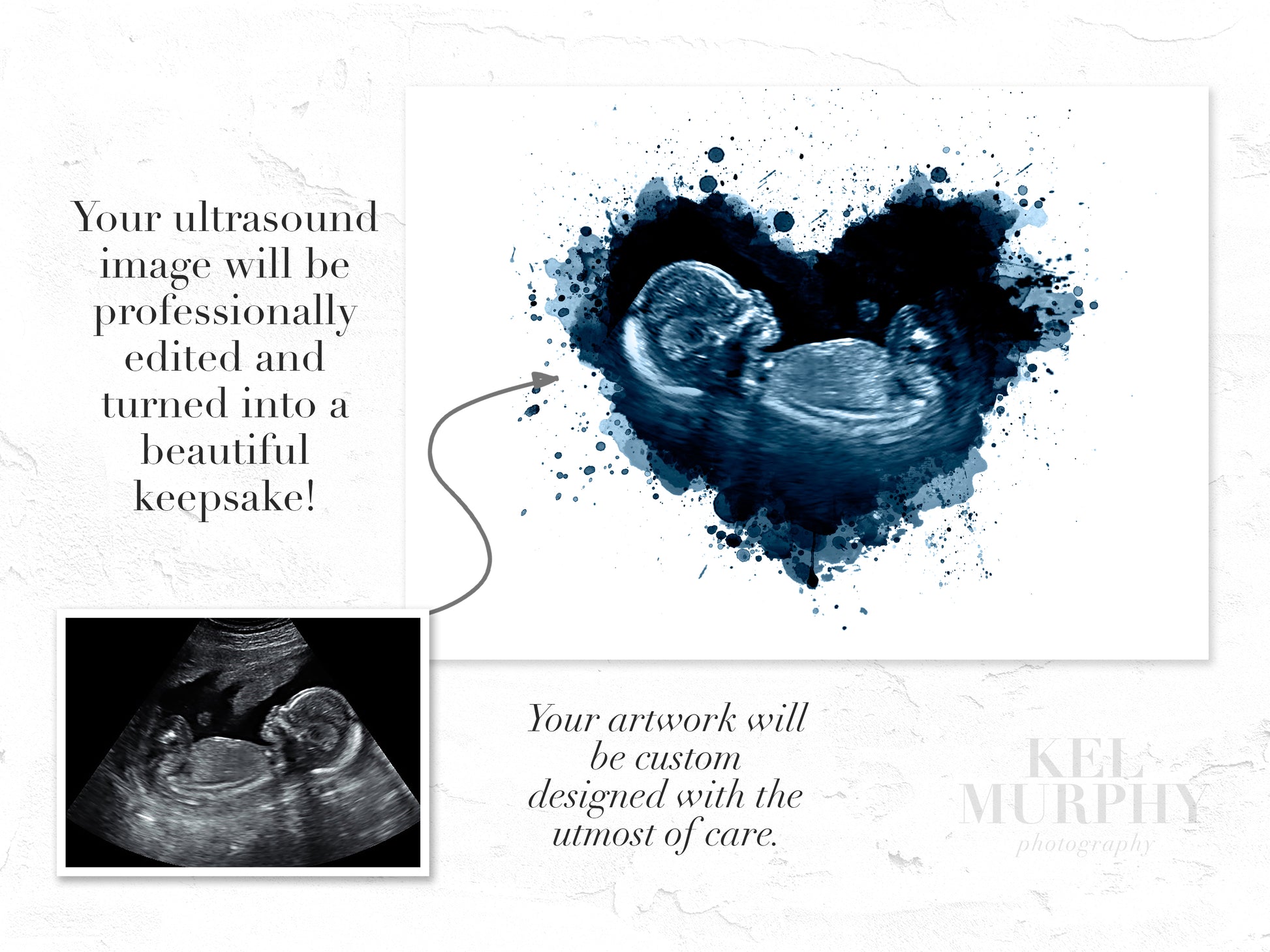 Before and after heart ultrasound sonogram to watercolor art print