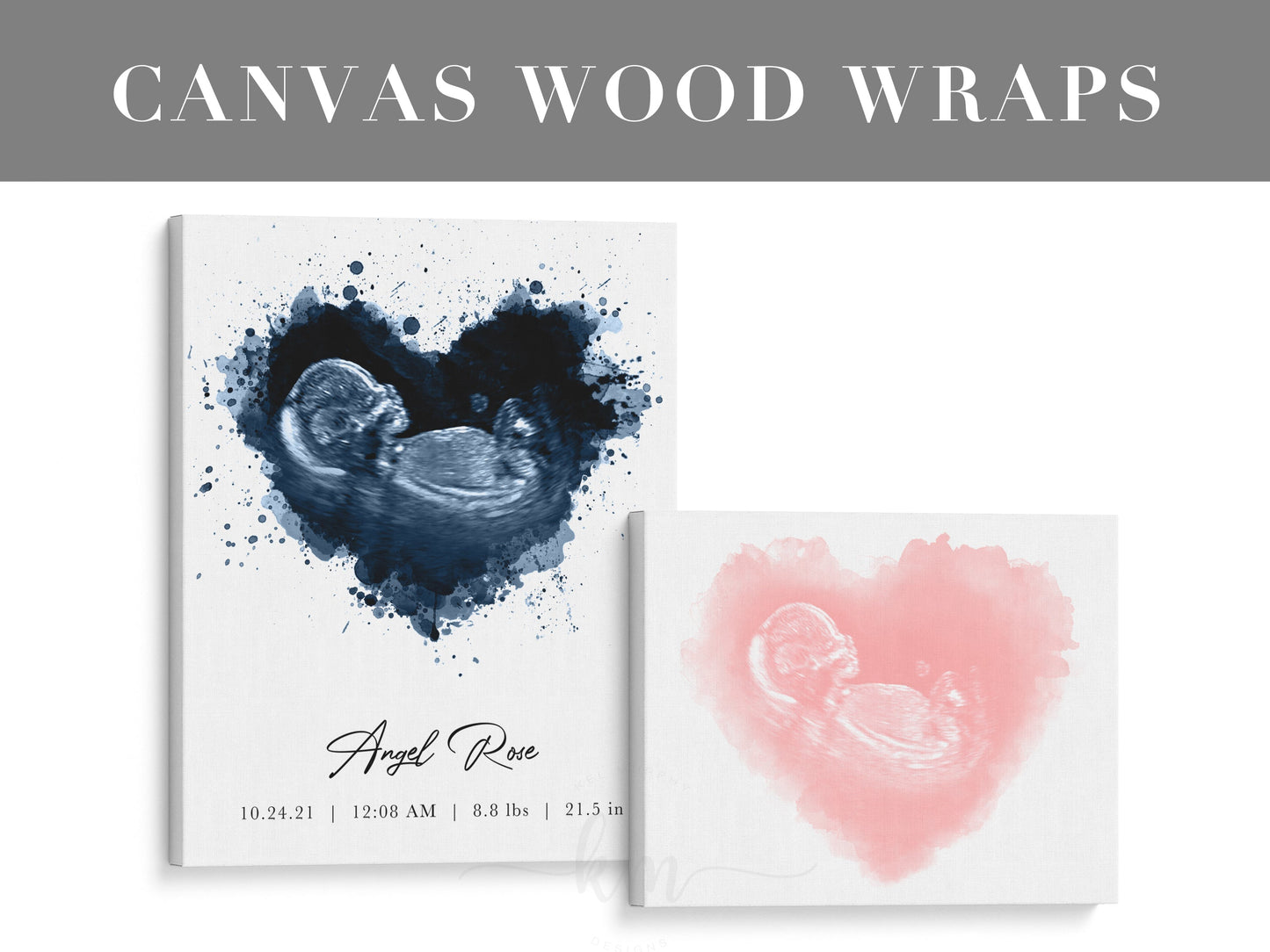 Rainbow Baby Splatter Heart Watercolor Ultrasound Art (Vertical)