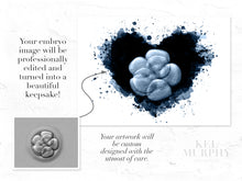 Load image into Gallery viewer, Embryo watercolor art print pen and ink before and after
