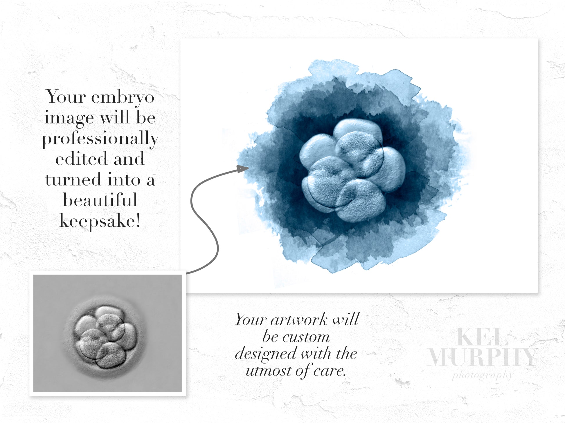 IVF Embryo watercolor art print before and after