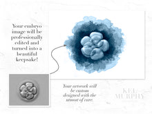 Load image into Gallery viewer, IVF Embryo watercolor art print before and after
