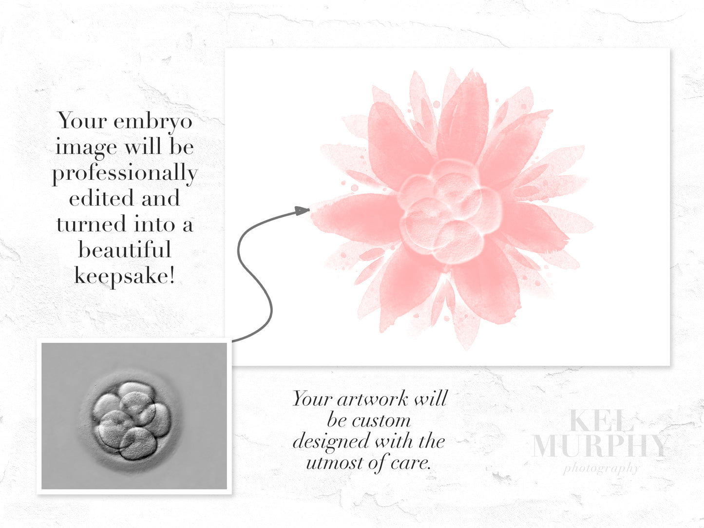 IVF Embryo ultrasound art print before and after fertility gift
