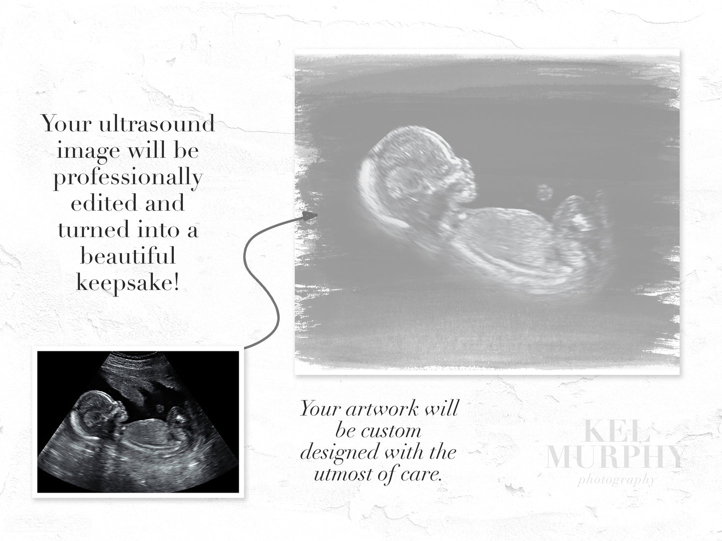 Painted background ultrasound art before and after custom gift