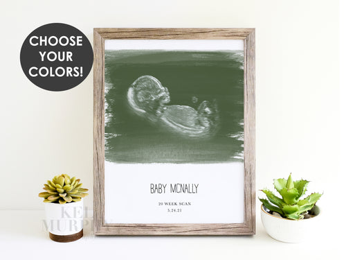 Painted ultrasound art print personalized name date framed