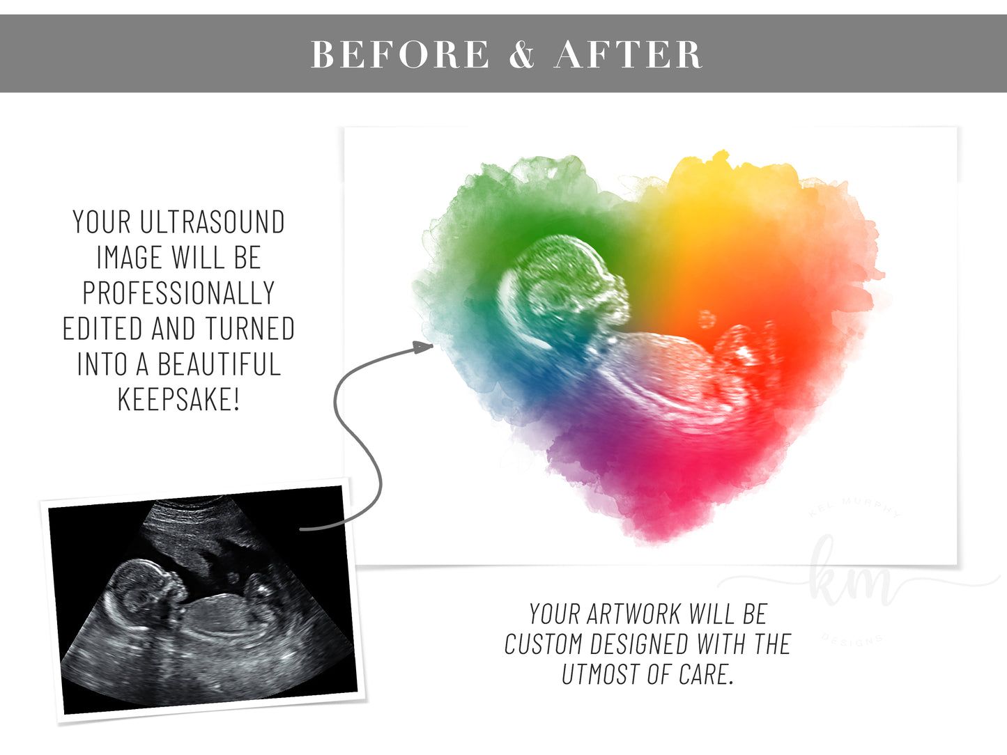 Rainbow Baby Heart Watercolor Ultrasound Art