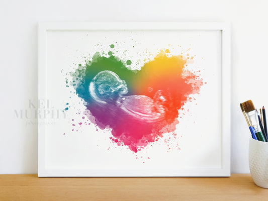 Rainbow baby miscarriage ultrasound sonogram art print gift for fertility