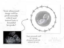 Load image into Gallery viewer, Sonogram ultrasound art print with heartbeat wave before and after
