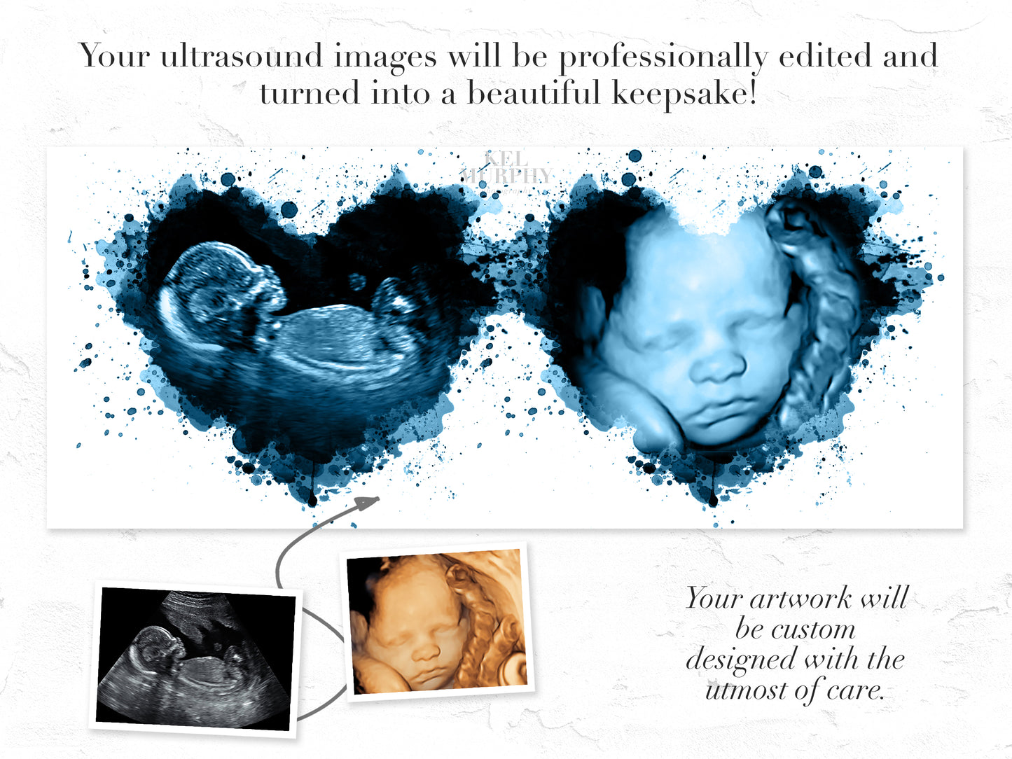 Two heart ultrasound watercolor art print sonogram 2d 23d before and after