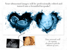 Load image into Gallery viewer, Two heart ultrasound watercolor art print sonogram 2d 23d before and after
