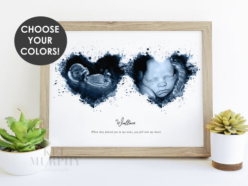 Two heart ultrasound watercolor art print sonogram 2d 3d framed new mom gift