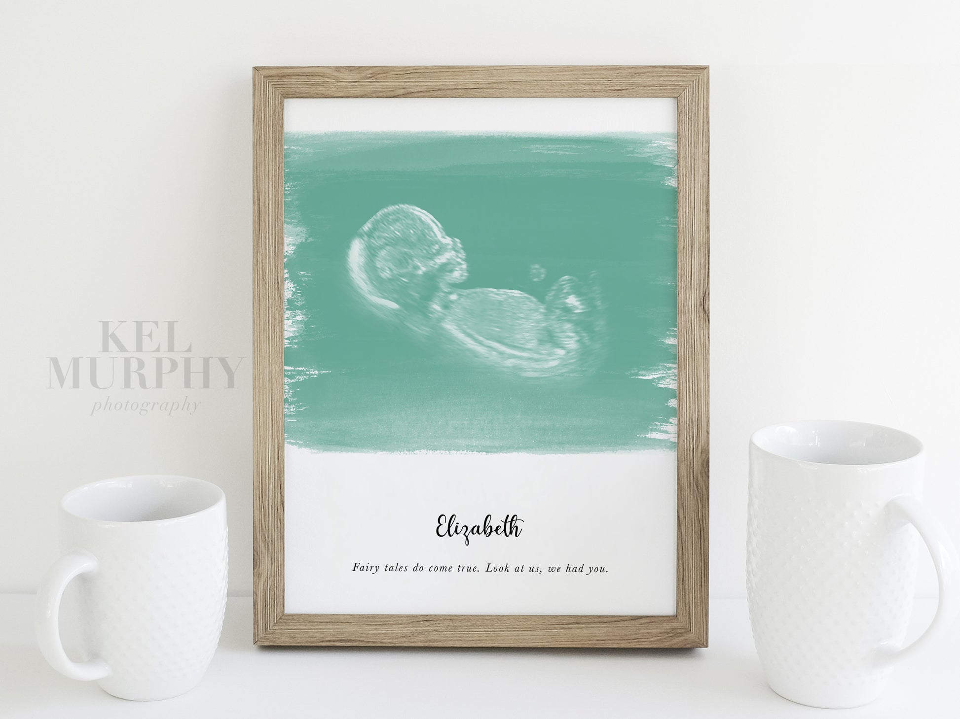 Ultrasound art print watercolor background turquoise mom gift framed