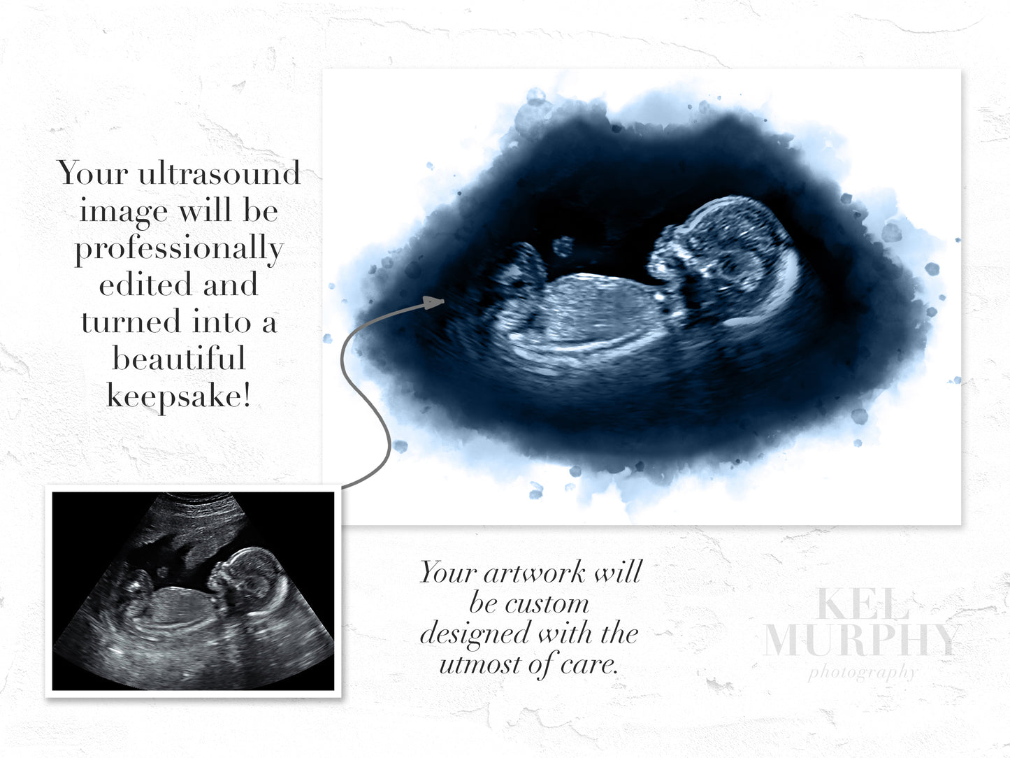 Ultrasound fetus watercolor art print before and after