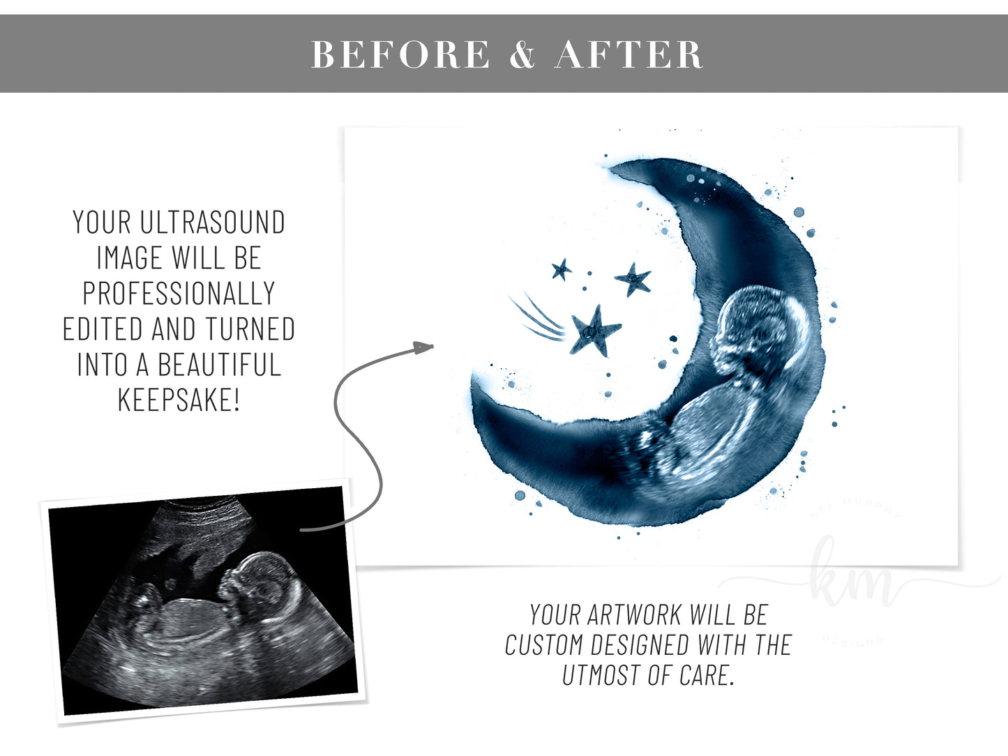 Moon and Stars Ultrasound Art with Baby Heartbeat
