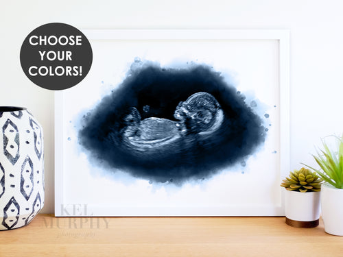 Ultrasound sonogram watercolor art print new mom gift surrogate framed