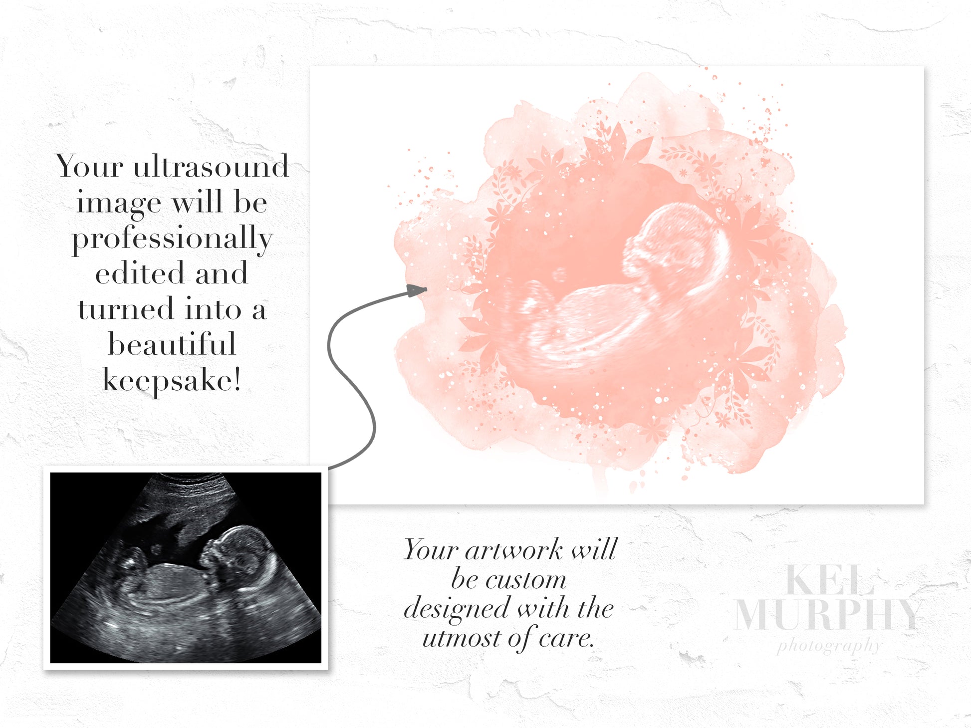 Ultrasound watercolor flowers art print before and after