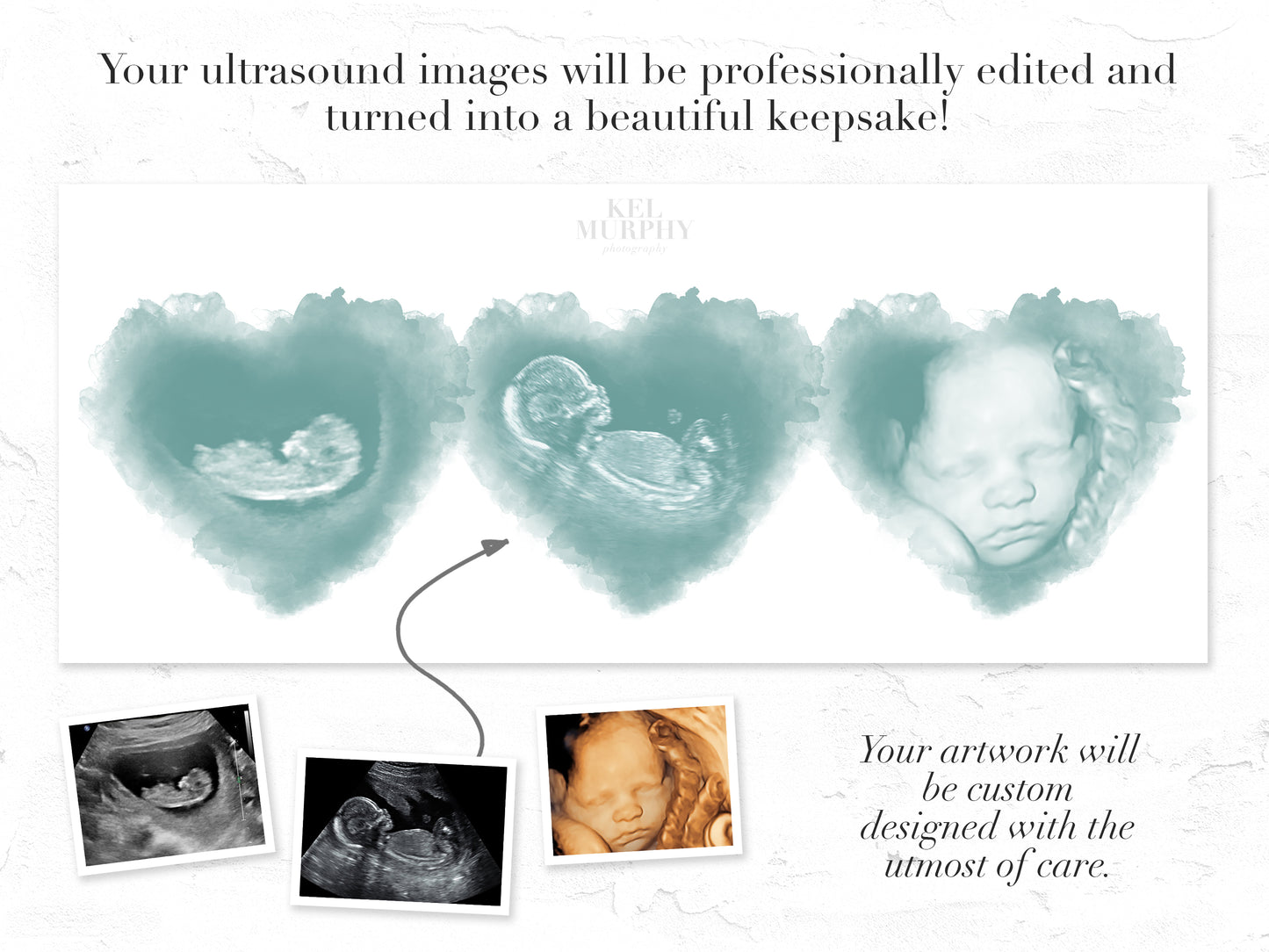 Ultrasound watercolor heart art print three triplets 2D 3D before and after