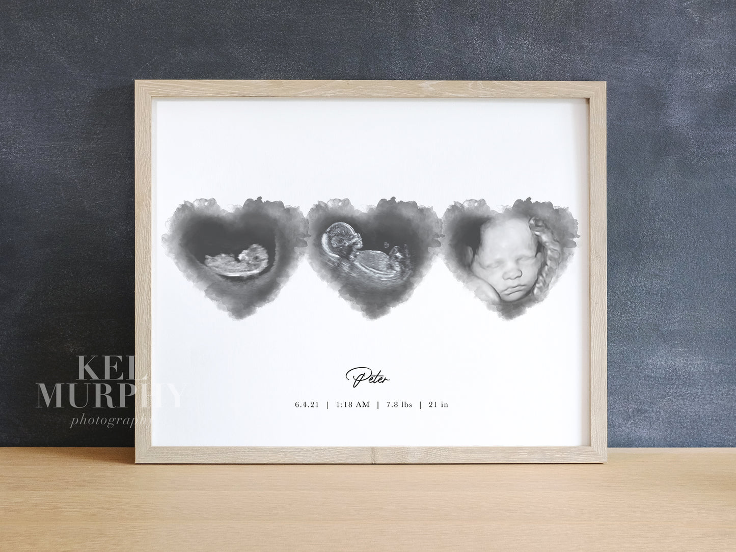Ultrasound watercolor hearts art print three triplets 2D 3D sonogram 2D 3D custom gift