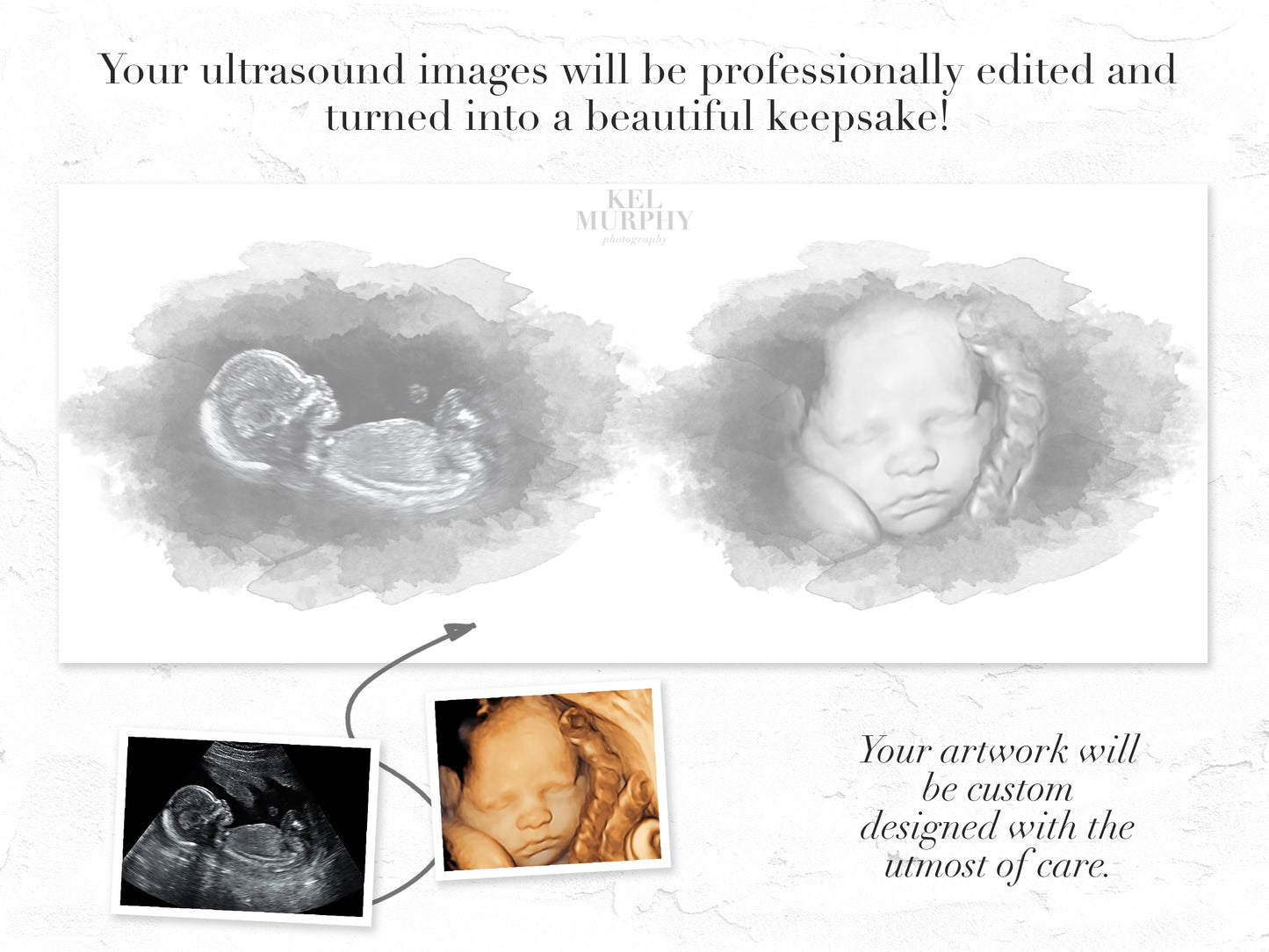 2D 3D ultrasound print watercolor custom personalized art print before and after