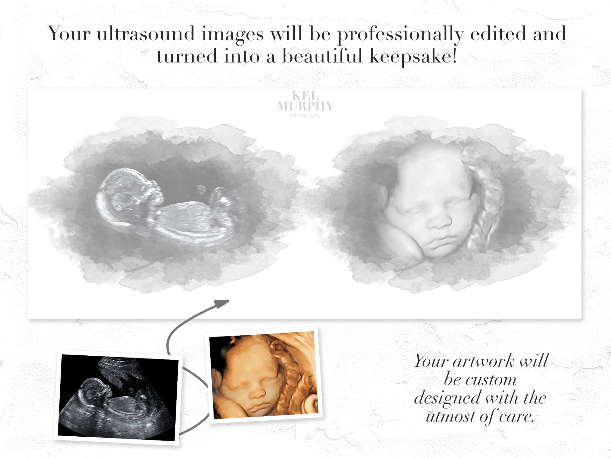 2D 3D ultrasound print watercolor custom personalized art print before and after