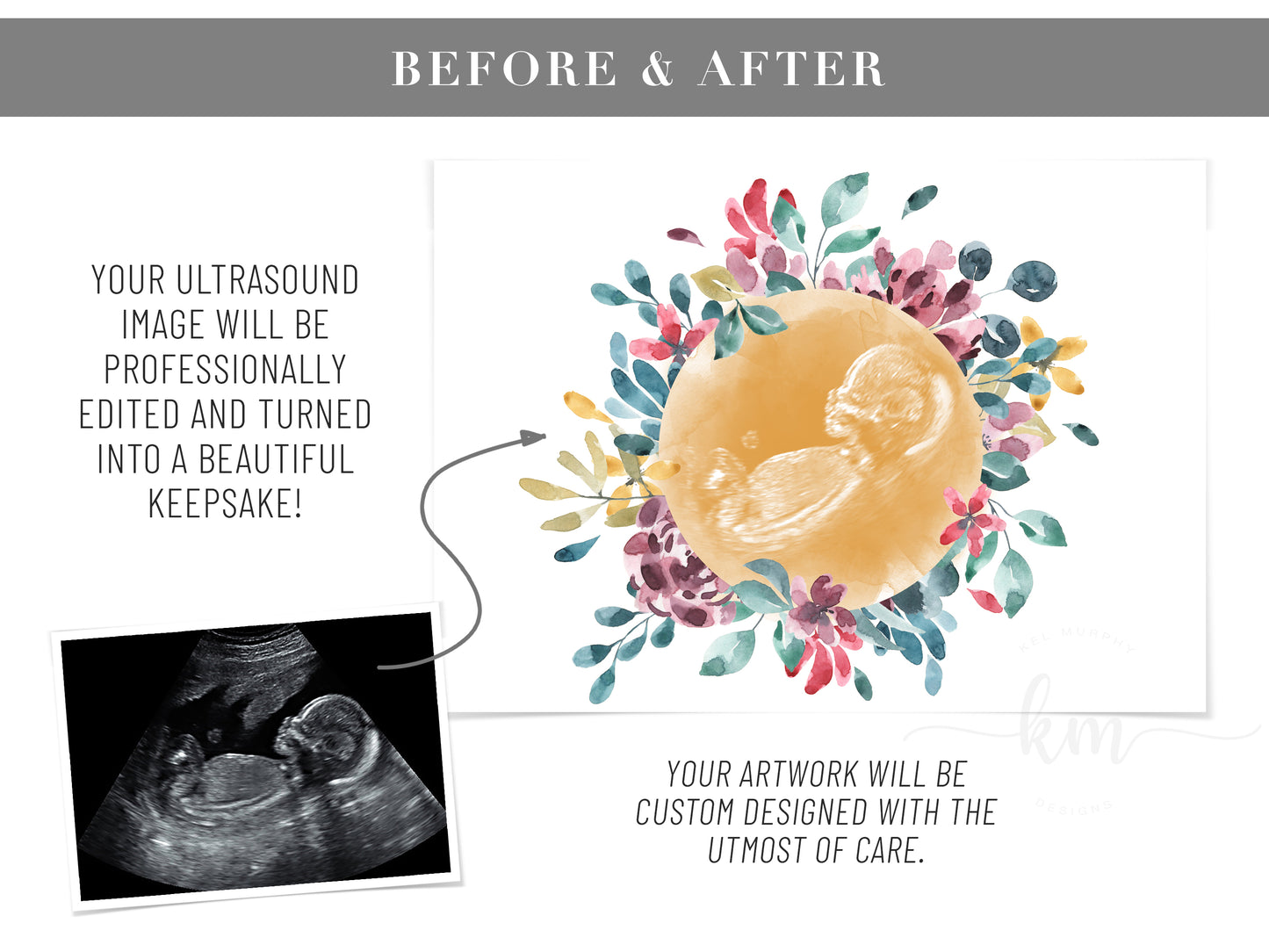 Flower Wreath Watercolor Ultrasound Art