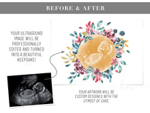 Load image into Gallery viewer, Flower Wreath Watercolor Ultrasound Art
