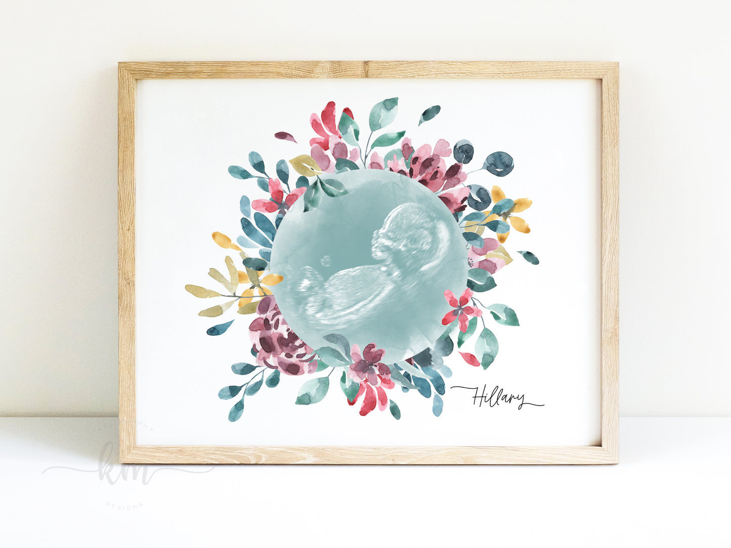 Flower Wreath Watercolor Ultrasound Art