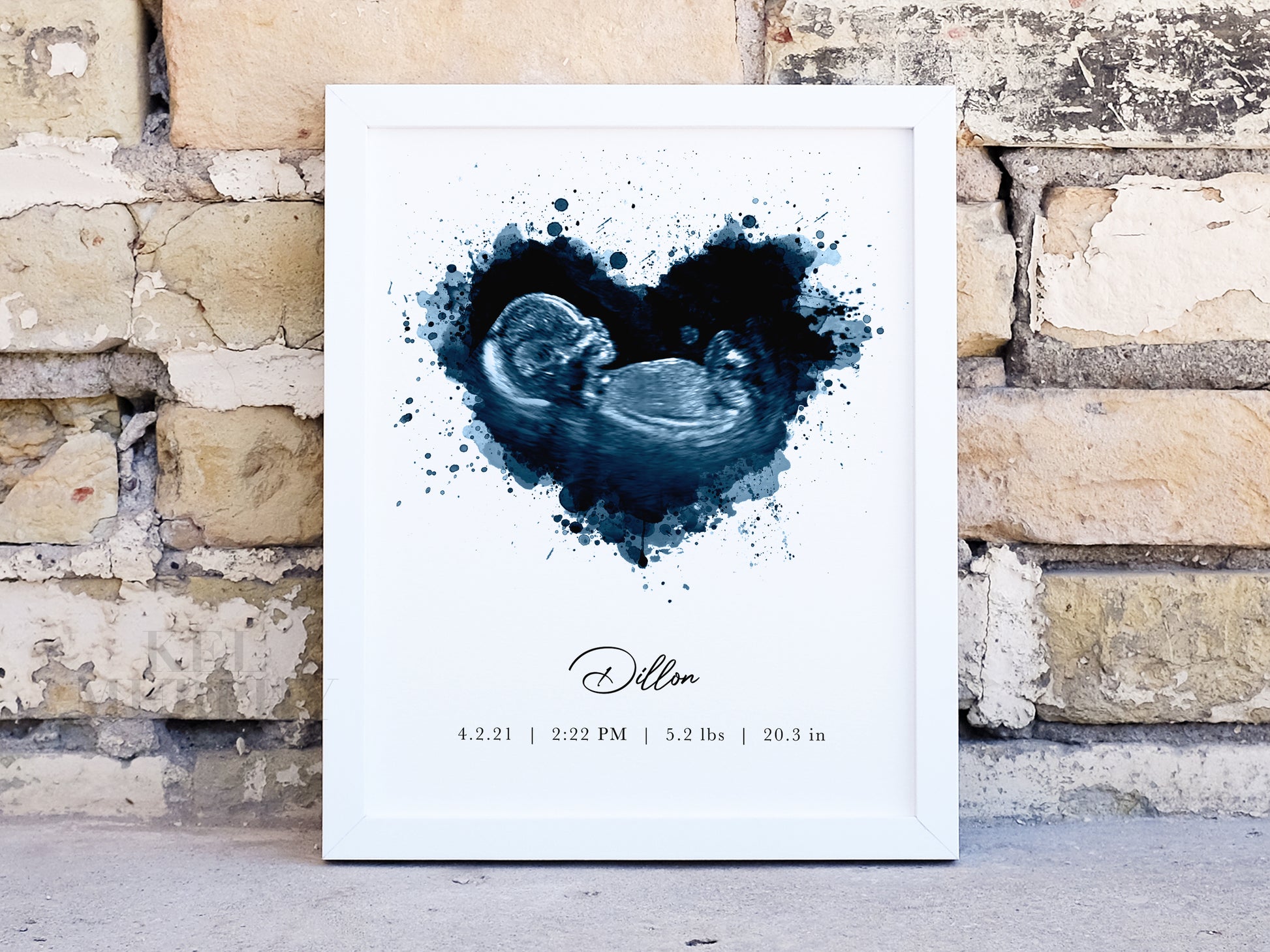 Watercolor ultrasound blue heart print with custom personalization in white frame