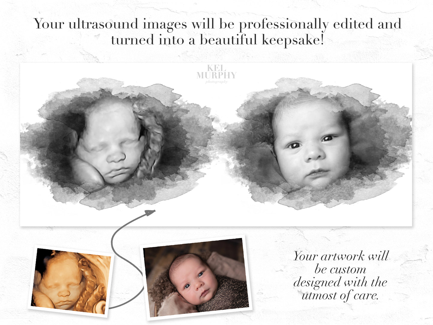 Watercolor ultrasound newborn photo before and after pregnancy announcement framed