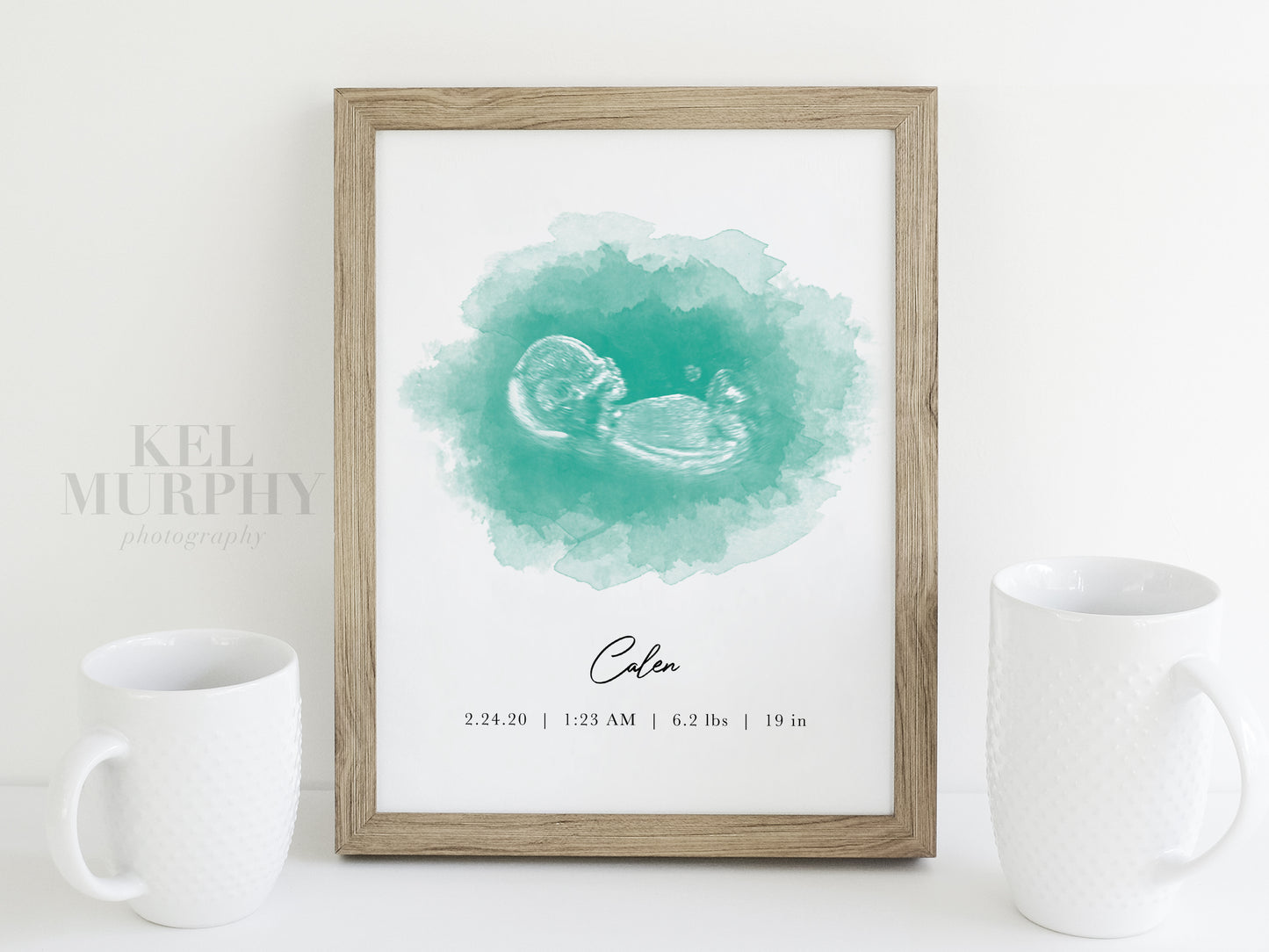 Watercolor ultrasound art print with circle custom personalized and framed